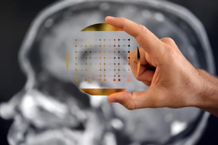 Công nghệ mở “cửa sổ vào não” – bước tiến mới trong điều trị ung thư não